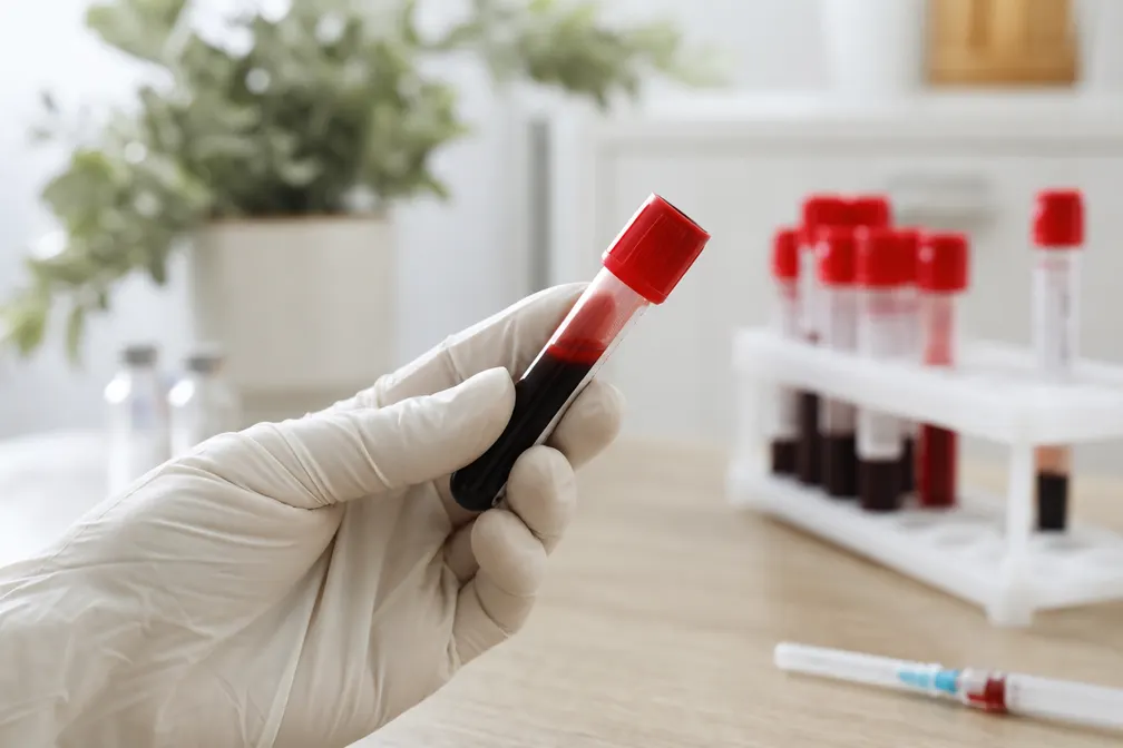 Gros plan sur les lignes d'un compte rendu d'analyses biologiques médicales annoté au stylo
